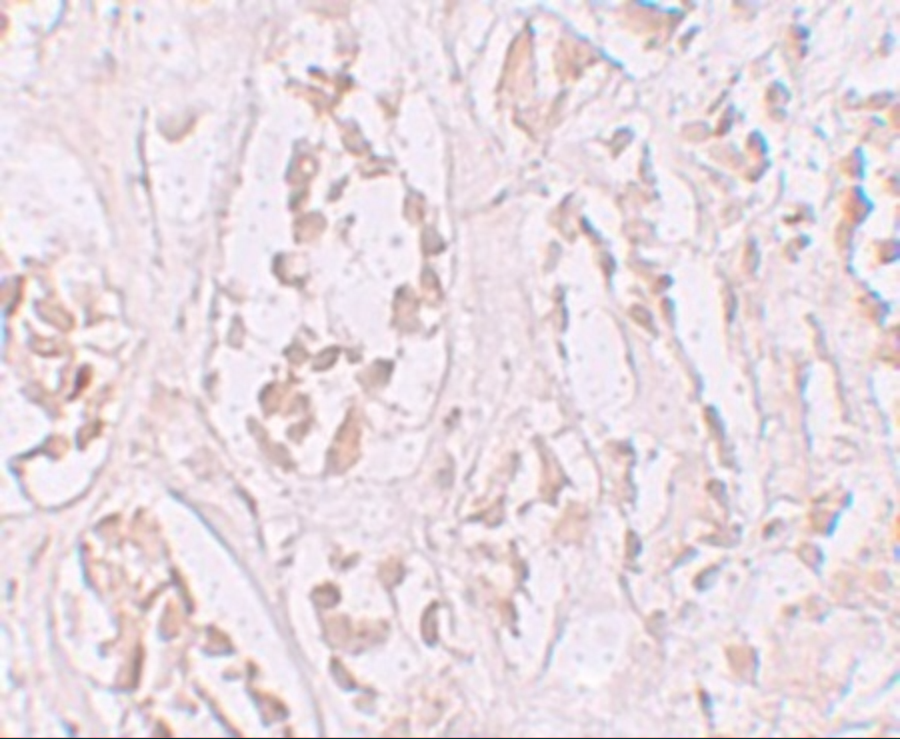 Immunohistochemistry of STOX2 in human kidney tissue with STOX2 antibody at 2.5 μg/mL. Immunohistochemistry of STOX2 in human kidney tissue with STOX2 antibody at 2.5 μg/mL.