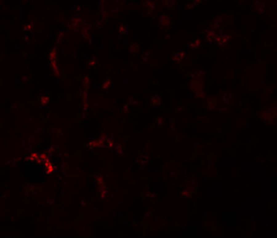 Immunofluorescence of SUMO3 in mouse liver tissue with SUMO3 antibody at 20 μg/mL. Immunofluorescence of SUMO3 in mouse liver tissue with SUMO3 antibody at 20 μg/mL.