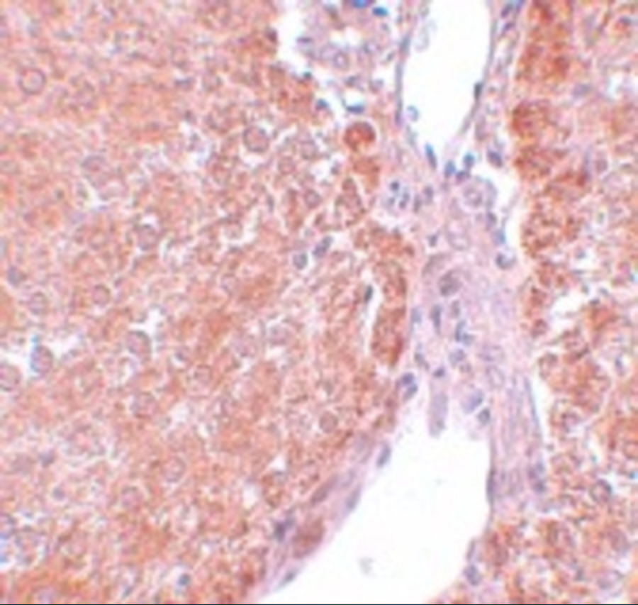Immunohistochemistry of SUMO2/3 in rat liver tissue with SUMO2/3 antibody at 5 μg/mL. Immunohistochemistry of SUMO2/3 in rat liver tissue with SUMO2/3 antibody at 5 μg/mL.