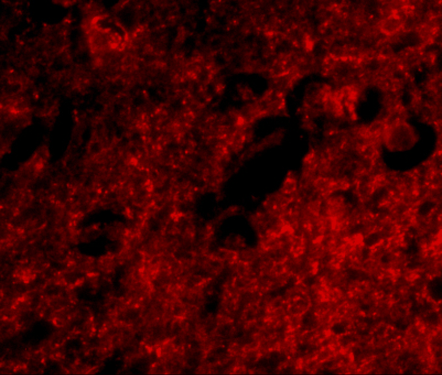 Immunofluorescence of slitrk1 in human brain tissue with slitrk1 antibody at 20 μg/mL. Immunofluorescence of slitrk1 in human brain tissue with slitrk1 antibody at 20 μg/mL.