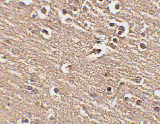 Immunohistochemistry of Slitrk1 in human brain tissue with Slitrk1 antibody at 2.5 μg/mL. Immunohistochemistry of Slitrk1 in human brain tissue with Slitrk1 antibody at 2.5 μg/mL.