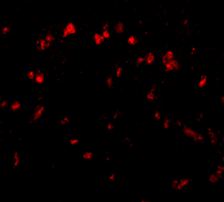 Immunofluorescence of Spred1 in Human Brain tissue with Spred1 antibody at 20 μg/mL. Immunofluorescence of Spred1 in Human Brain tissue with Spred1 antibody at 20 μg/mL.