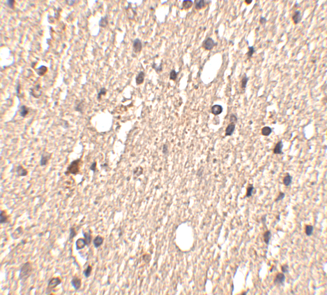 Immunohistochemistry of Spred1 in human brain tissue with Spred1 antibody at 2.5 μg/mL. Immunohistochemistry of Spred1 in human brain tissue with Spred1 antibody at 2.5 μg/mL.