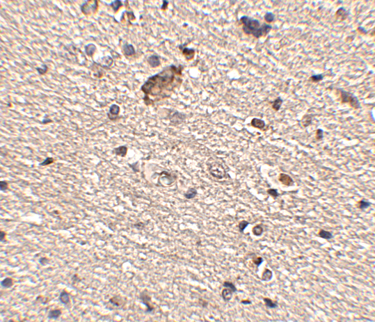 Immunohistochemistry of Spred1 in human brain tissue with Spred1 antibody at 2.5 μg/mL. Immunohistochemistry of Spred1 in human brain tissue with Spred1 antibody at 2.5 μg/mL.