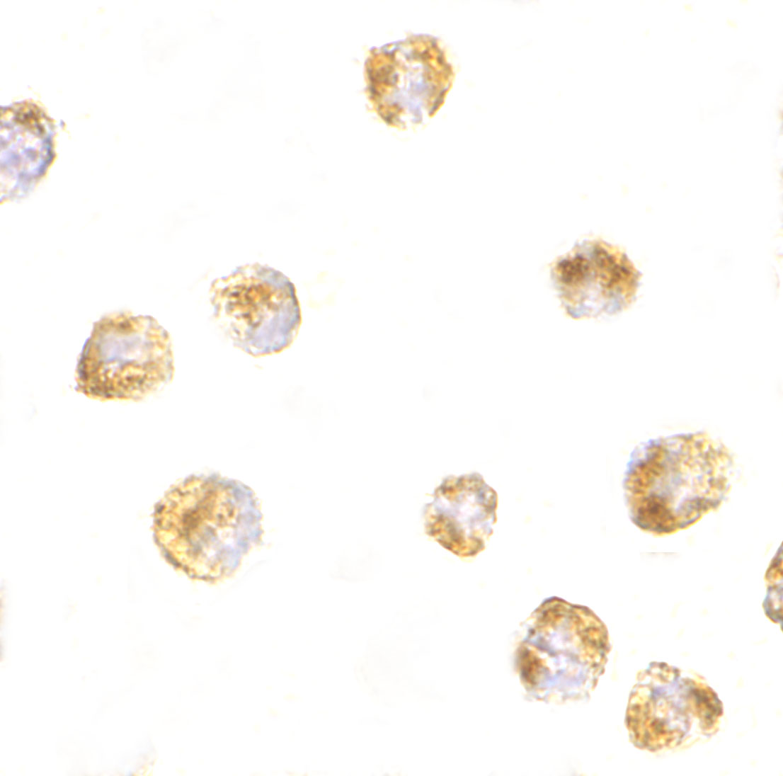 Immunocytochemistry of Sumo in HL60 cells with Sumo antibody at 5 μg/mL. Immunocytochemistry of Sumo in HL60 cells with Sumo antibody at 5 μg/mL.