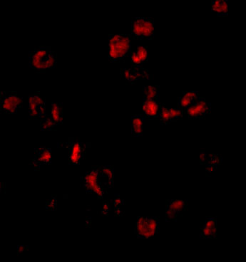 Immunofluorescence of Sumo in HL60 cells with Sumo antibody at 20 μg/mL. Immunofluorescence of Sumo in HL60 cells with Sumo antibody at 20 μg/mL.