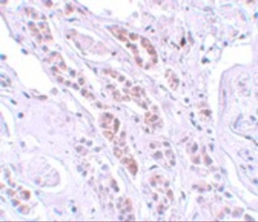 Immunohistochemistry of TCTN1 in human kidney tissue with TCTN1 antibody at 5 μg/mL. Immunohistochemistry of TCTN1 in human kidney tissue with TCTN1 antibody at 5 μg/mL.