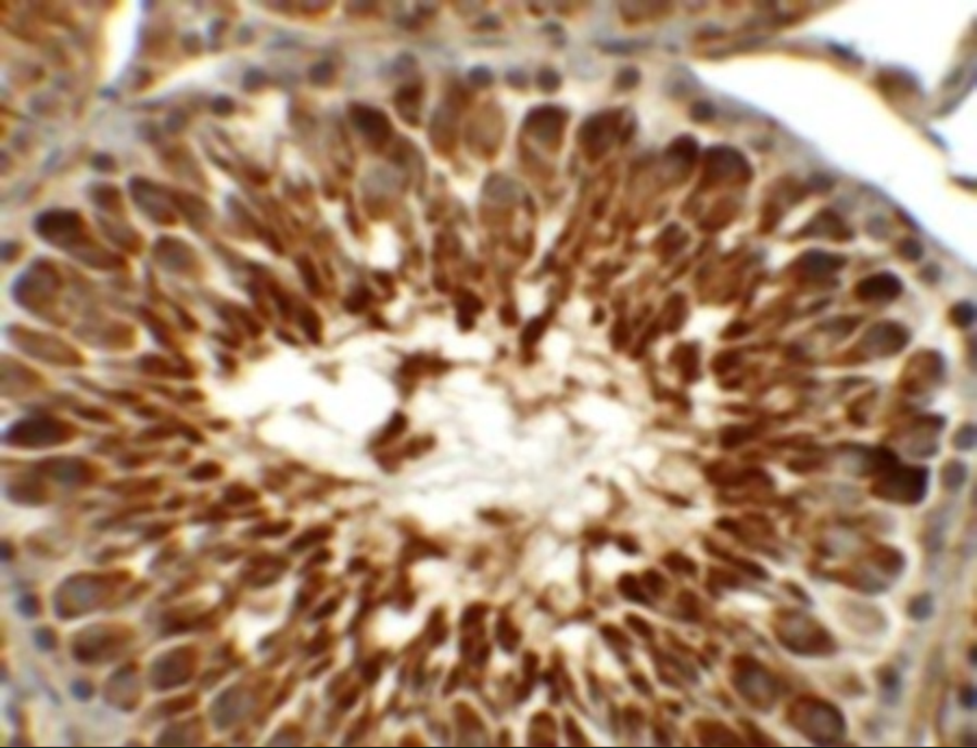 Immunohistochemistry of TEKT5 in rat testis tissue with TEKT5 antibody at 5 μg/mL. Immunohistochemistry of TEKT5 in rat testis tissue with TEKT5 antibody at 5 μg/mL.