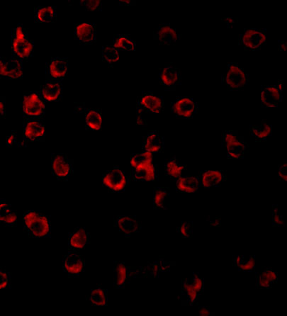 Immunofluorescence of TLR11 in Raw264.7 cells with TLR11 antibody at 10 μg/mL. Immunofluorescence of TLR11 in Raw264.7 cells with TLR11 antibody at 10 μg/mL.