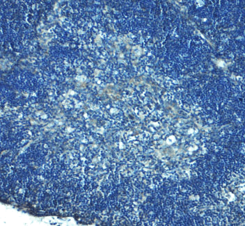 Immunohistochemistry of TLR8 in mouse thymus tissue with TLR8 Antibody at 5 μg/mL. Immunohistochemistry of TLR8 in mouse thymus tissue with TLR8 Antibody at 5 μg/mL.