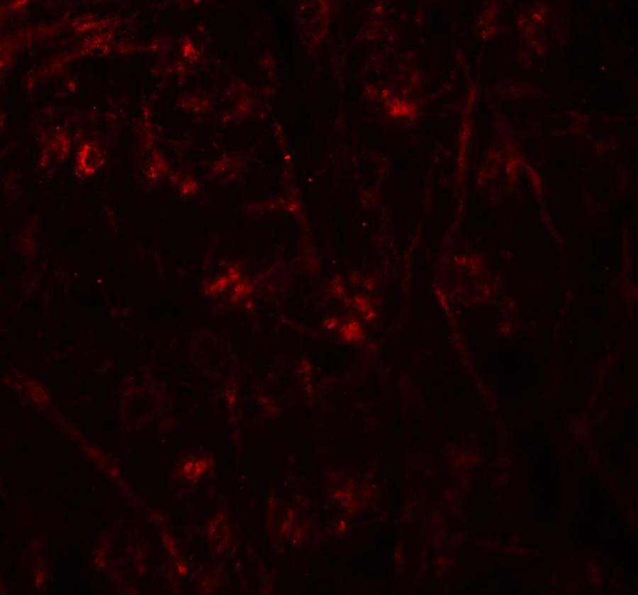 Immunofluorescence of TMEM106A in mouse brain tissue with TMEM106A antibody at 20 μg/mL. Immunofluorescence of TMEM106A in mouse brain tissue with TMEM106A antibody at 20 μg/mL.