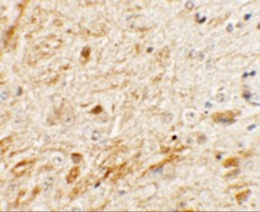 Immunohistochemistry of TMEM106A in mouse brain tissue with TMEM106A antibody at 5 μg/mL. Immunohistochemistry of TMEM106A in mouse brain tissue with TMEM106A antibody at 5 μg/mL.
