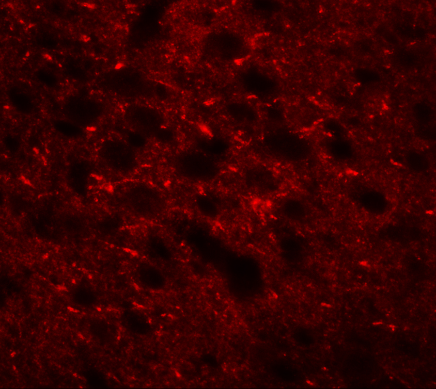 Immunofluorescence of TMEM88 in mouse brain tissue with TMEM88 antibody at 20 μg/mL. Immunofluorescence of TMEM88 in mouse brain tissue with TMEM88 antibody at 20 μg/mL.