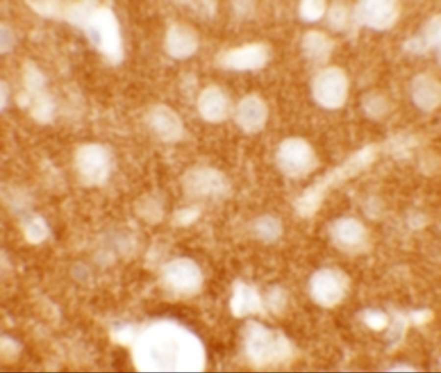 Immunohistochemistry of TMEM88 in mouse brain tissue with TMEM88 antibody at 2.5 μg/mL. Immunohistochemistry of TMEM88 in mouse brain tissue with TMEM88 antibody at 2.5 μg/mL.
