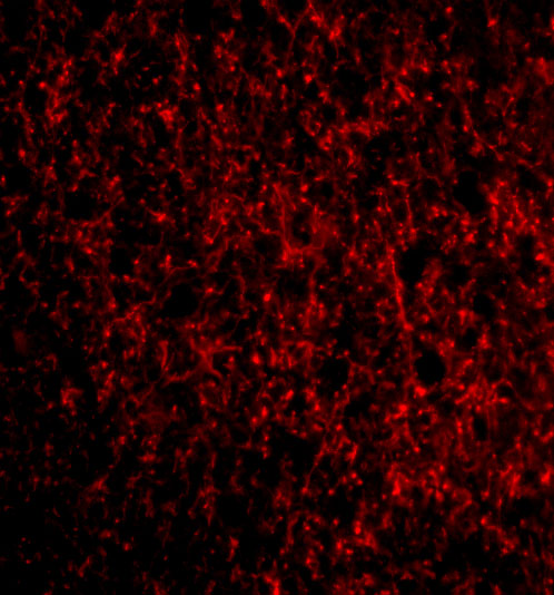 Immunofluorescence of TMP21 in Human Brain cells with TMP21 antibody at 20 μg/mL. Immunofluorescence of TMP21 in Human Brain cells with TMP21 antibody at 20 μg/mL.