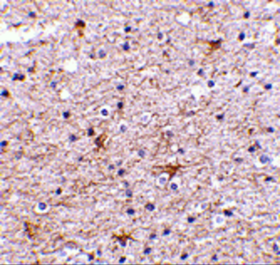 Immunohistochemistry of TMP21 in human brain tissue with TMP21 antibody at 2.5 μg/mL. Immunohistochemistry of TMP21 in human brain tissue with TMP21 antibody at 2.5 μg/mL.