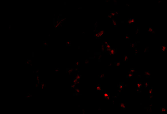 Immunofluorescence of TP-1 in Human Lung cells with TP-1 antibody at 20 μg/mL.
