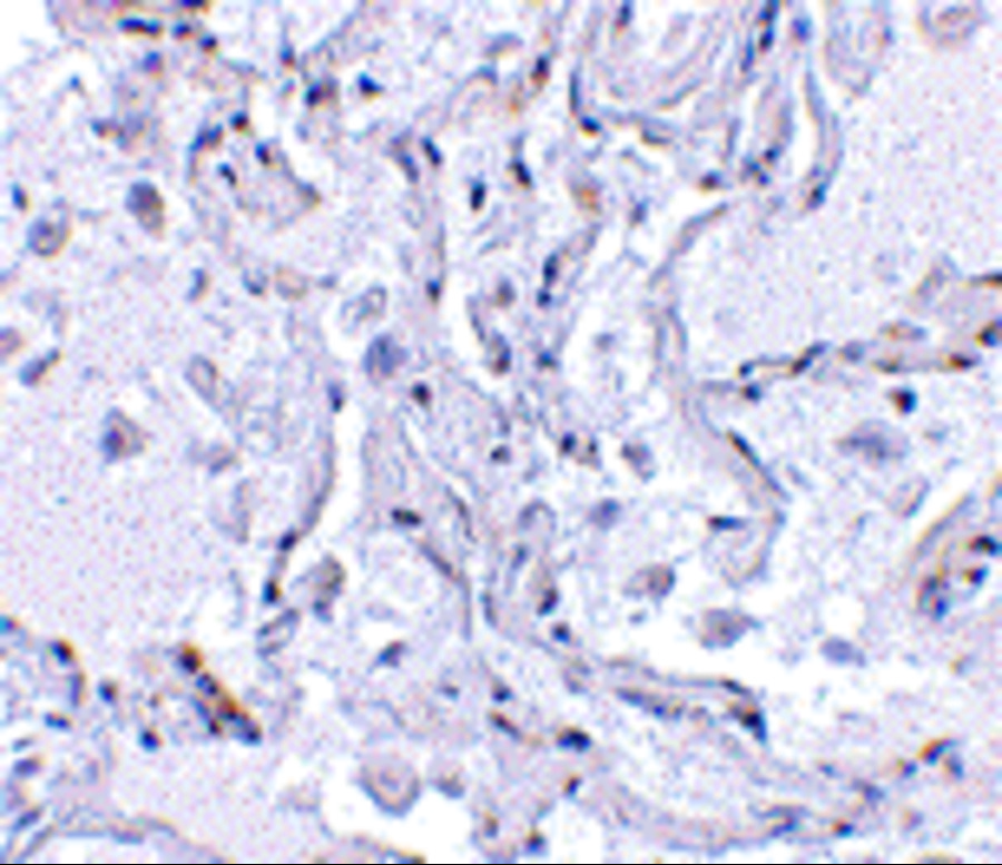 Immunohistochemical staining of human lung tissue using TP1 antibody at 2.5 μg/mL.