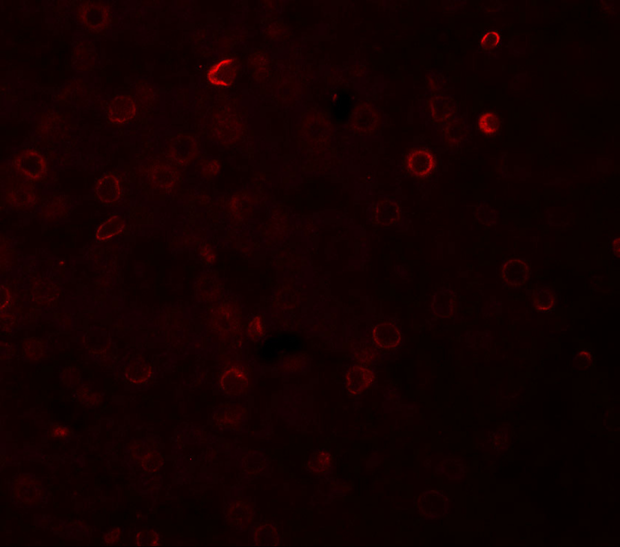 Immunofluorescence of TRAP in human liver tissue with TRAP antibody at 20 μg/mL. Immunofluorescence of TRAP in human liver tissue with TRAP antibody at 20 μg/mL.