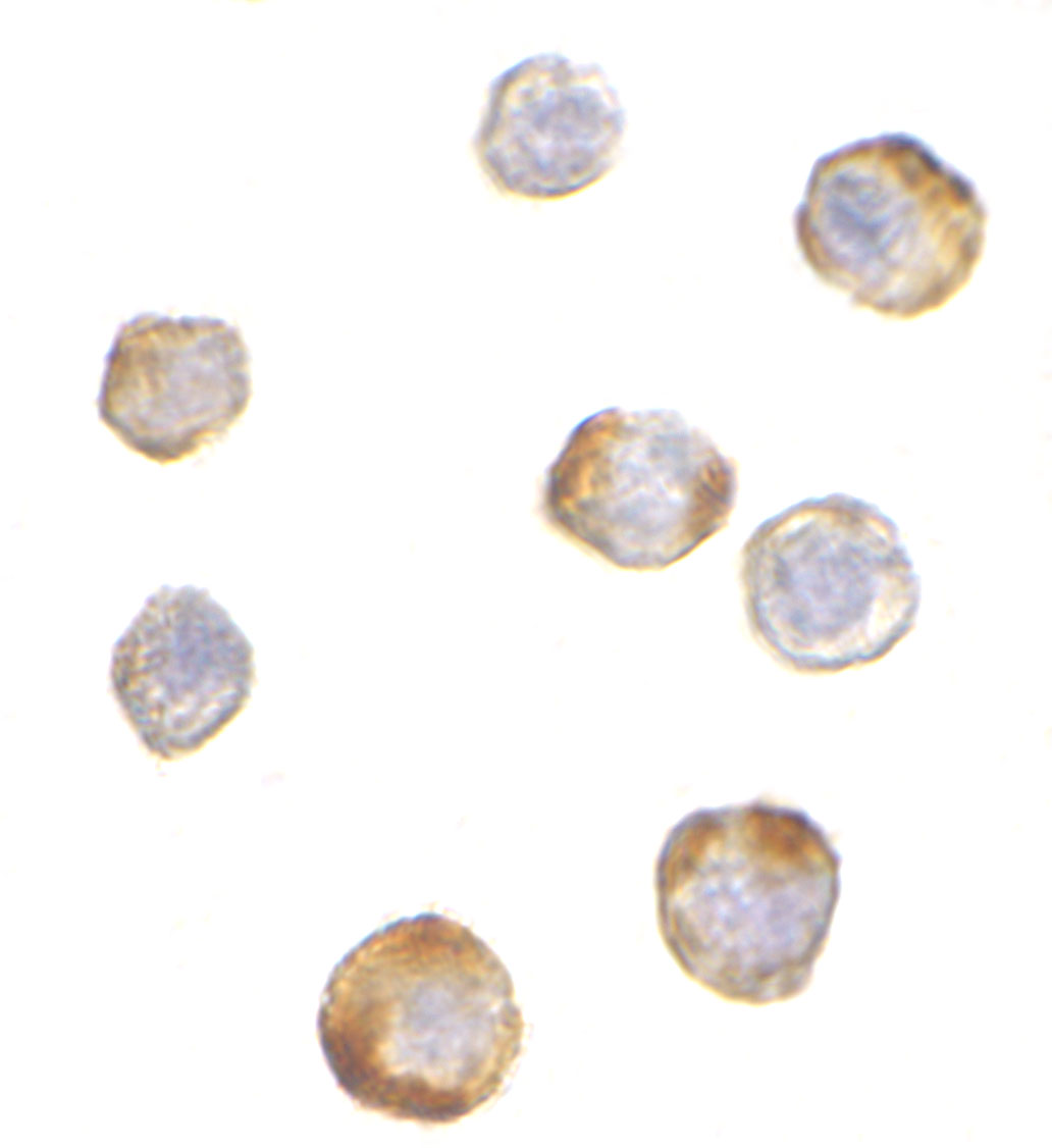 Immunocytochemistry of TRIM25 in HeLa cells with TRIM25 antibody at 5 μg/mL. Immunocytochemistry of TRIM25 in HeLa cells with TRIM25 antibody at 5 μg/mL.