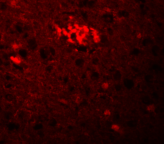 Immunofluorescence of TRIM71 in Human Brain cells with TRIM71 antibody at 20 μg/mL. Immunofluorescence of TRIM71 in Human Brain cells with TRIM71 antibody at 20 μg/mL.