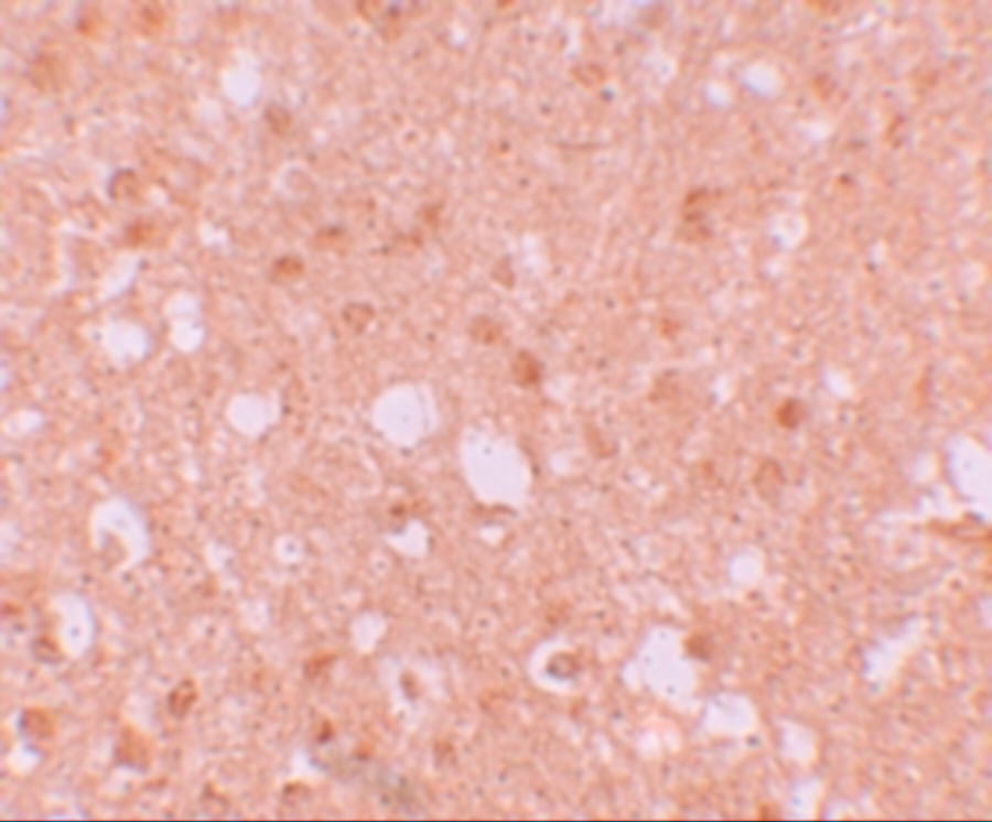Immunohistochemistry of TRIM71 in human brain tissue with TRIM71 antibody at 5 μg/mL. Immunohistochemistry of TRIM71 in human brain tissue with TRIM71 antibody at 5 μg/mL.