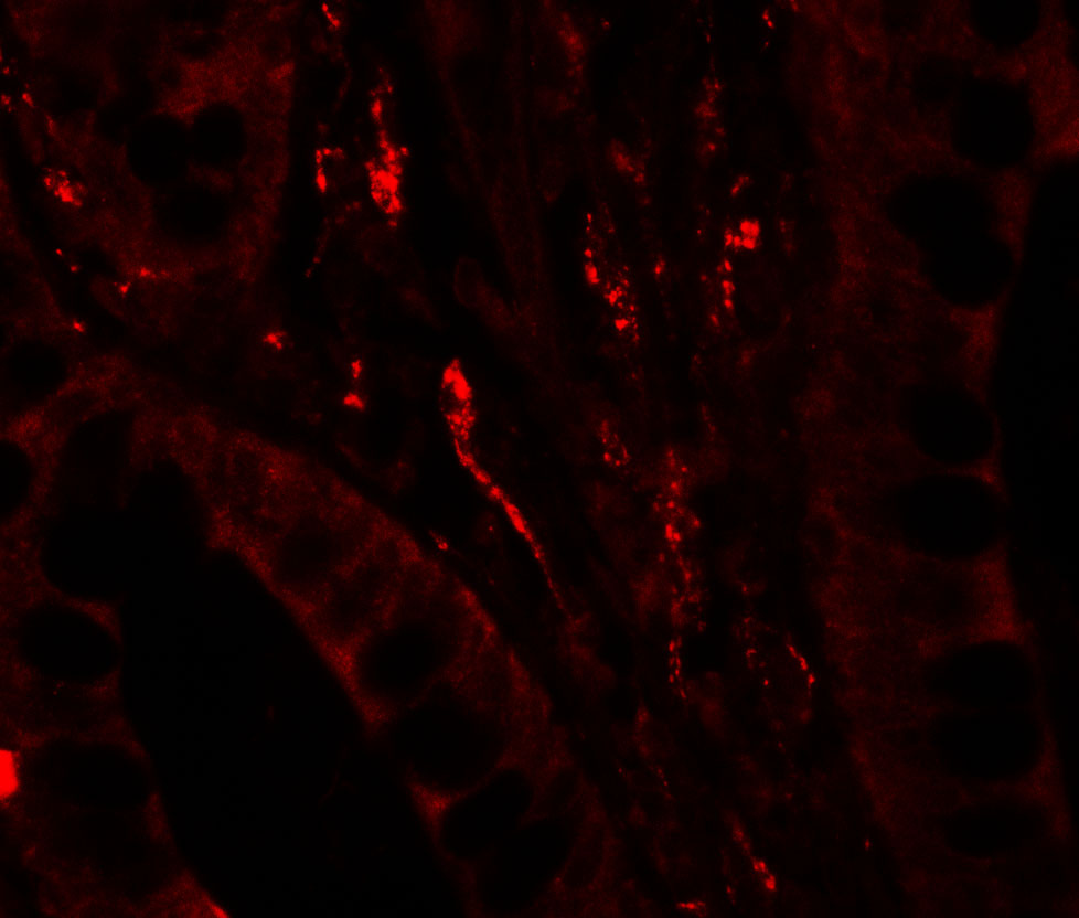 Immunofluorescence of TSC22D3 in human small intestine tissue with TSC22D3 antibody at 20 μg/ml. Immunofluorescence of TSC22D3 in human small intestine tissue with TSC22D3 antibody at 20 μg/ml.