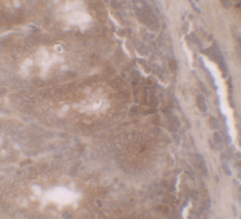 Immunohistochemistry of TSC22D3 in human small intestine tissue with TSC22D3 antibody at 5 μg/ml. Immunohistochemistry of TSC22D3 in human small intestine tissue with TSC22D3 antibody at 5 μg/ml.