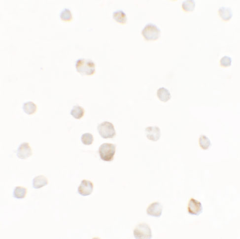 Immunocytochemistry of TTYH1 in Raji cells with TTYH1 antibody at 5 μg/mL. Immunocytochemistry of TTYH1 in Raji cells with TTYH1 antibody at 5 μg/mL.