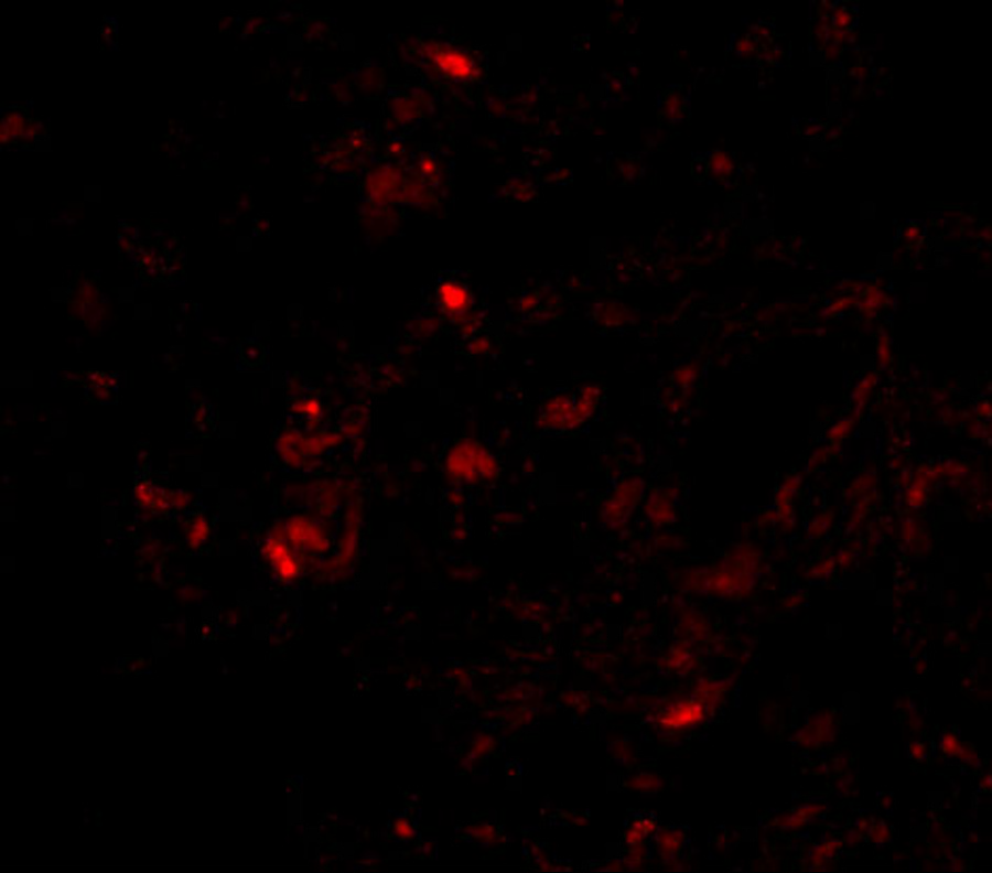 Immunofluorescence of Transthyretin in human lung tissue with Transthyretin antibody at 20 μg/mL. Immunofluorescence of Transthyretin in human lung tissue with Transthyretin antibody at 20 μg/mL.