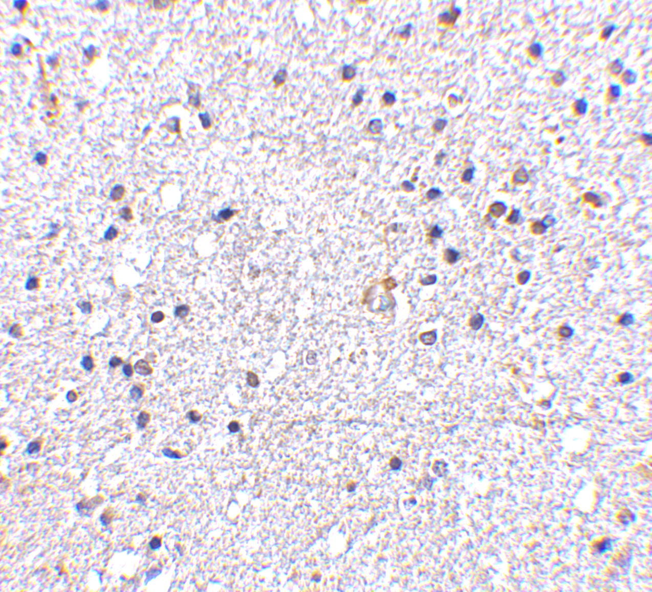 Immunohistochemistry of VISA in human brain tissue with VISA antibody at 5 μg/mL. Immunohistochemistry of VISA in human brain tissue with VISA antibody at 5 μg/mL.