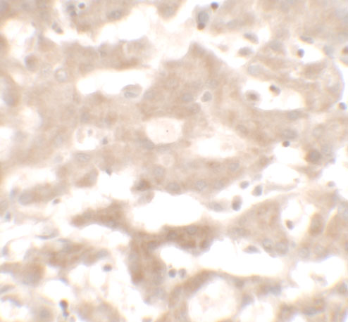 Immunohistochemistry of VNN3 in human liver tissue with VNN3 antibody at 5 μg/mL. Immunohistochemistry of VNN3 in human liver tissue with VNN3 antibody at 5 μg/mL.