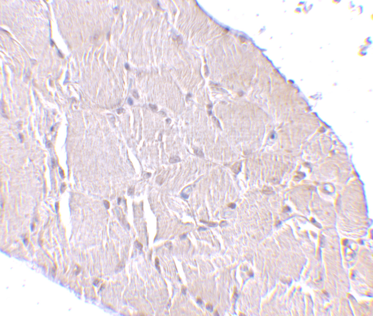 Immunohistochemistry of Wnt10a in human skeletal muscle tissue with Wnt10a antibody at 10 μg/mL.