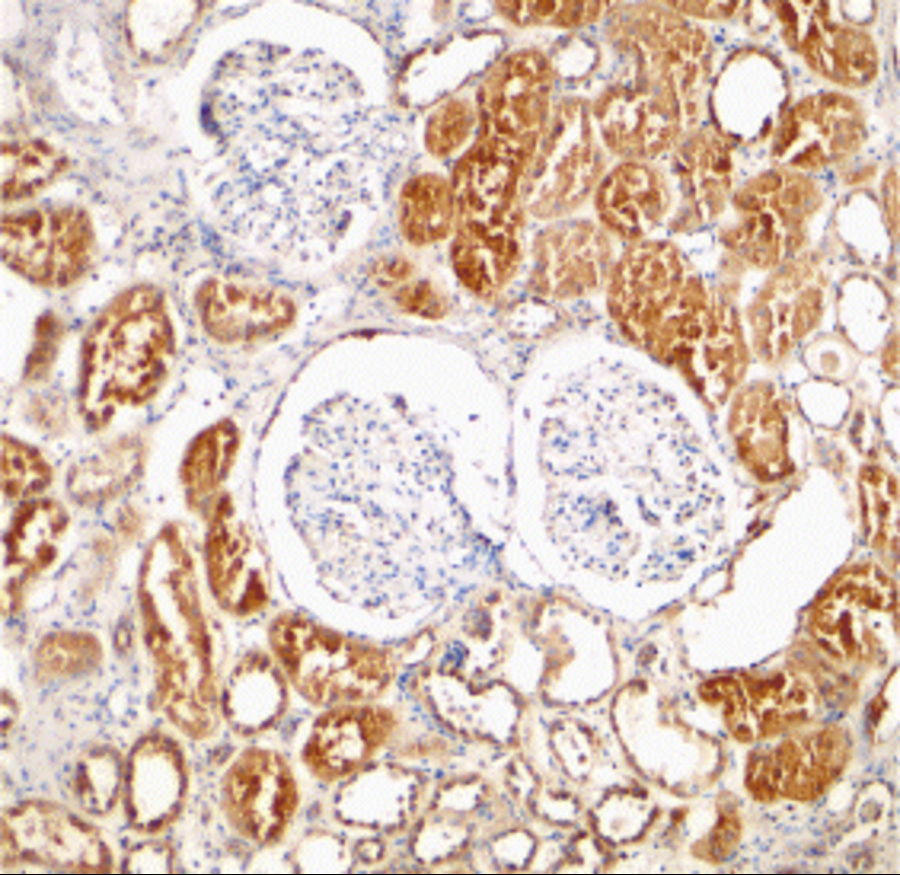 Immunohistochemical staining of human kidney tissue using XIAP antibody at 2 μg/mL. Immunohistochemical staining of human kidney tissue using XIAP antibody at 2 μg/mL.