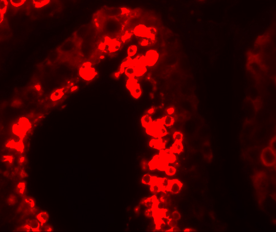 Immunofluorescence of YBX2 in human testis tissue with YBX2 antibody at 20 μg/mL. Immunofluorescence of YBX2 in human testis tissue with YBX2 antibody at 20 μg/mL.