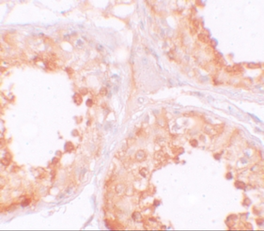 Immunohistochemistry of YBX2 in human testis tissue with YBX2 antibody at 10 μg/mL. Immunohistochemistry of YBX2 in human testis tissue with YBX2 antibody at 10 μg/mL.