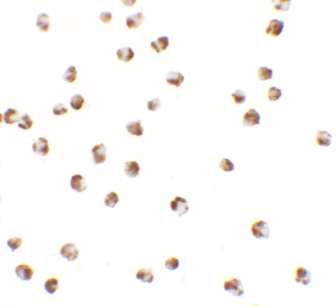 Immunocytochemistry of YPEL3 in A20 cells with YPEL3 antibody at 2.5 μg/mL. Immunocytochemistry of YPEL3 in A20 cells with YPEL3 antibody at 2.5 μg/mL.