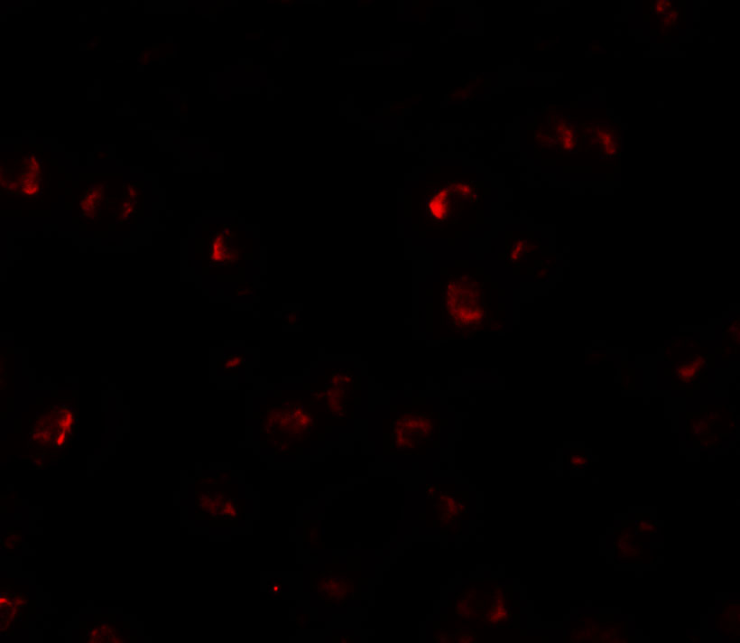 Immunofluorescence of YPEL3 in A20 cells with YPEL3 antibody at 5 μg/mL. Immunofluorescence of YPEL3 in A20 cells with YPEL3 antibody at 5 μg/mL.
