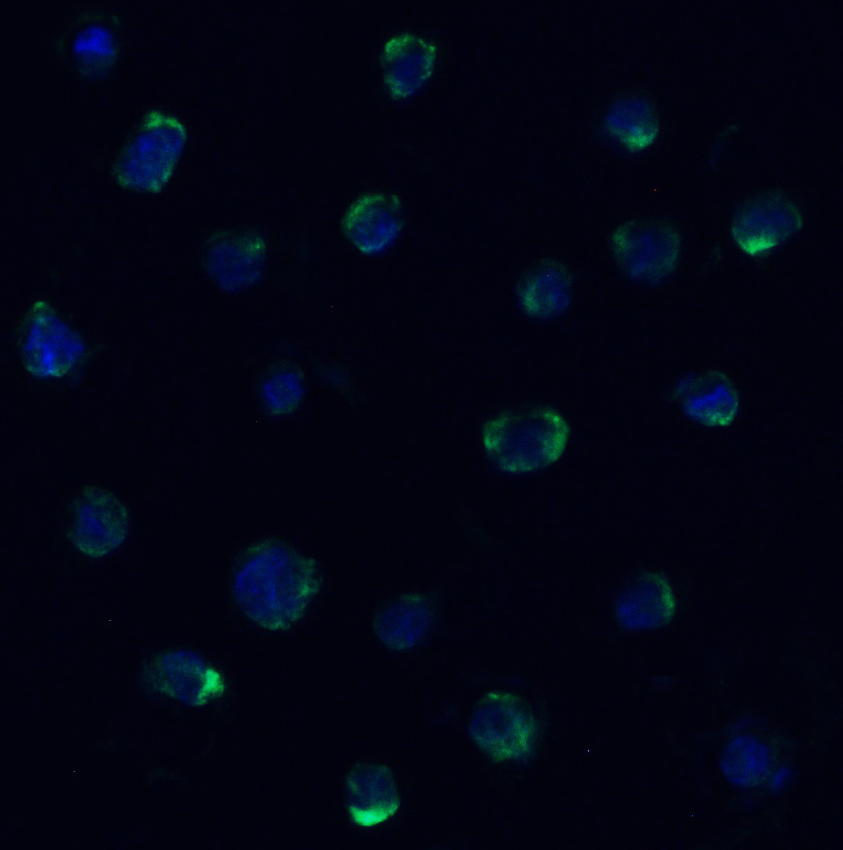 <strong>Figure 8 Immunofluorescence Validation of ZBP1 in Human K562 Cells </strong><br>
Immunofluorescent analysis of 4% paraformaldehyde-fixed K562 labeling ZBP1 with 4401 at 20 μg/mL, followed by goat anti-rabbit IgG secondary antibody at 1/500 dilution (green) and DAPI staining (blue).