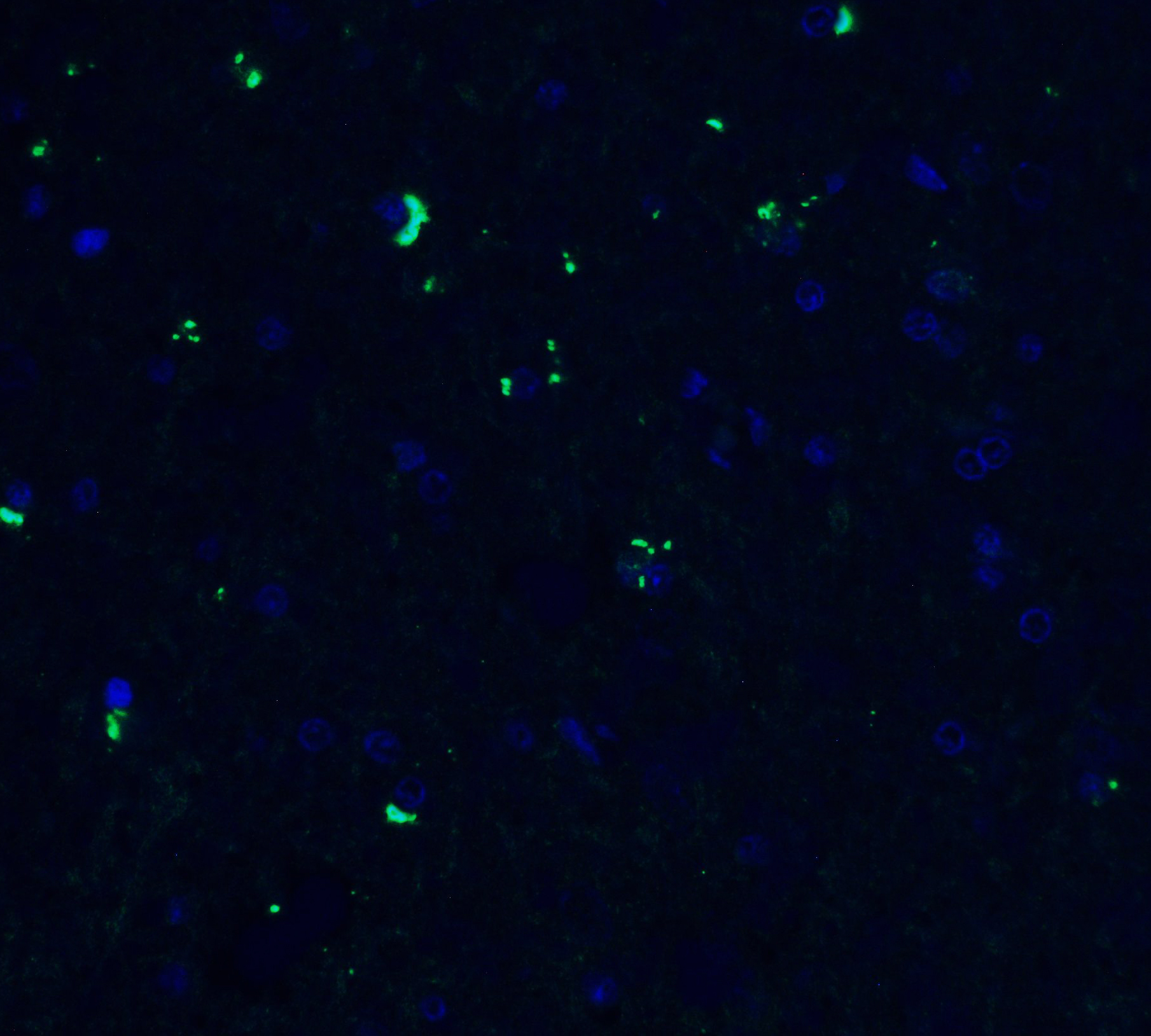 <strong>Figure 9 Immunofluorescence Validation of ZBP1 in Rat Brain </strong><br>
Immunofluorescent analysis of 4% paraformaldehyde-fixed rat brain labeling ZBP1 with 4401 at 20 μg/mL, followed by goat anti-rabbit IgG secondary antibody at 1/500 dilution (green) and DAPI staining (blue).