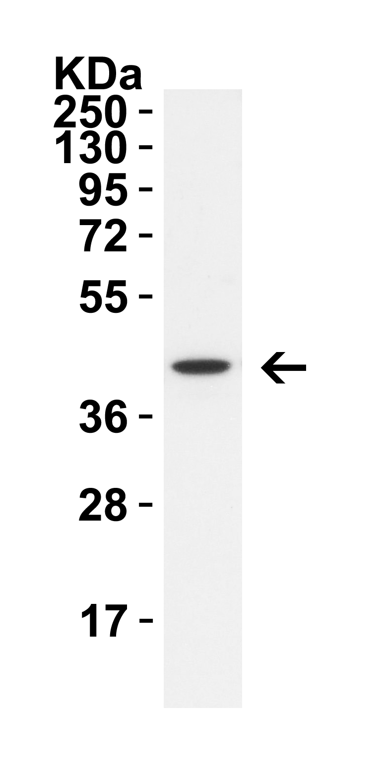 <strong>Figure 5 WB Validation in A549 Cells</strong><br>
Loading: 10 μg of lysate. 
Antibodies: ZBP1 4401, 1 μg/mL , 1 h incubation at RT in 8% NFDM/TBST. 
Secondary: Goat Anti-Rabbit IgG HRP conjugate at 1:10,000 dilution