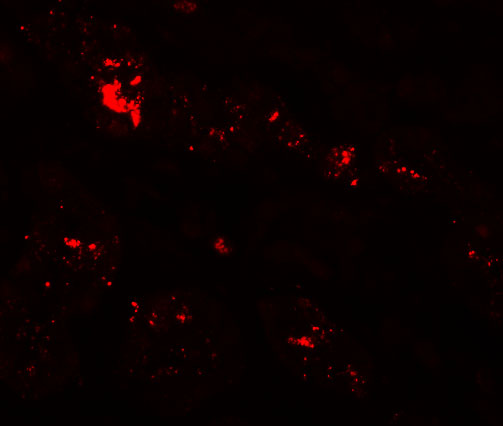 Immunofluorescence of ZIP1 in human kidney tissue with ZIP1 antibody at 20 μg/mL. Immunofluorescence of ZIP1 in human kidney tissue with ZIP1 antibody at 20 μg/mL.