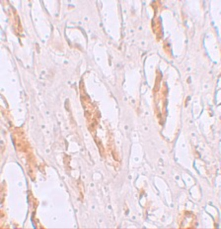 Immunohistochemistry of ZIP1 in human kidney tissue with ZIP1 antibody at 2.5 μg/mL. Immunohistochemistry of ZIP1 in human kidney tissue with ZIP1 antibody at 2.5 μg/mL.