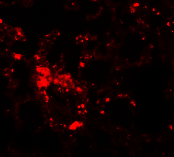 Immunofluorescence of ZIP6 in mouse lung tissue with ZIP6 antibody at 20 μg/mL.