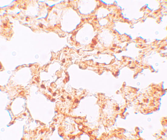 Immunohistochemistry of ZIP6 in mouse lung tissue with ZIP6 antibody at 5 μg/mL.