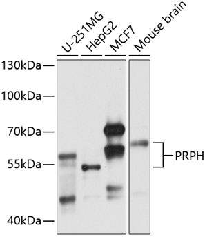PRPH Antibody - Cat. No. 19-256 | ProSci