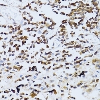 PIKFYVE Antibody Cat. No. 22407 ProSci