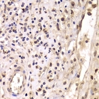 HDAC4 Antibody - Cat. No. 23-304 | ProSci