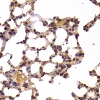 HDAC4 Antibody - Cat. No. 23-304 | ProSci