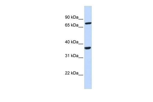 CCRL2 Antibody - Cat. No. 25-176 | ProSci